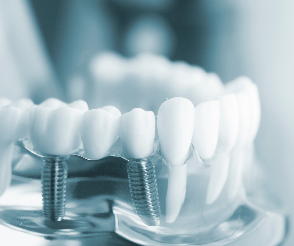 Start the Year with a Brighter Smile with a Cosmetic Dentist Near Edina